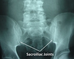 sacroiliac joints